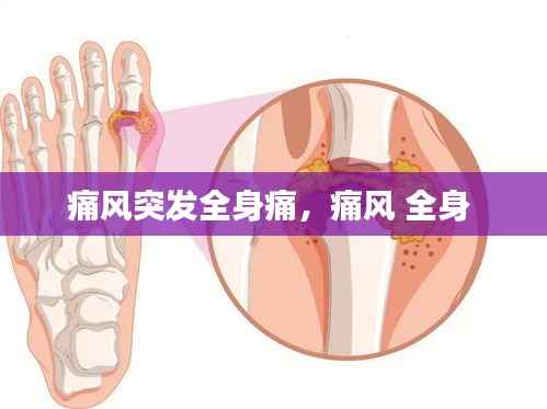 痛风突发全身痛,痛风 全身