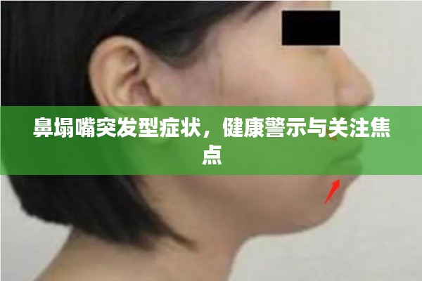 鼻塌嘴突发型症状,健康警示与关注焦点