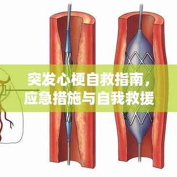 突发心梗自救指南,应急措施与自我救援方法